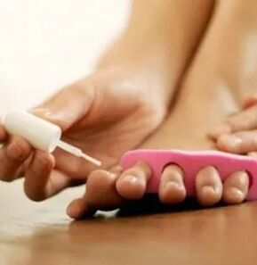 Terapötik vernik uygulaması